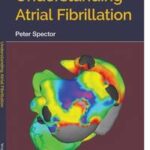Understanding Atrial Fibrillation