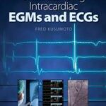 Understanding Intracardiac EGMs and ECGs
