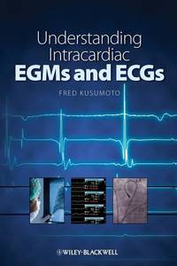 understanding-intracardiac-egms-ecgs-fred-m-9781405184106