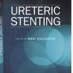 Ureteric Stenting