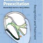 Variants of Ventricular Preexcitation